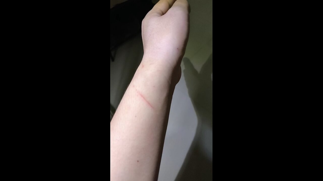 Black Devil scratches me at night.