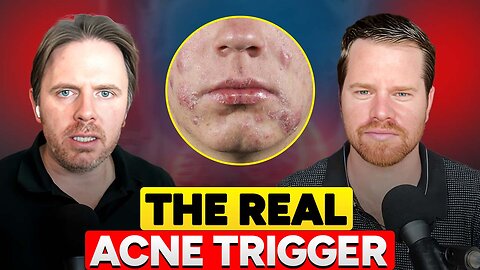 The Real Cause of Stubborn Acne: Gut Dysbiosis & Hormone Detox