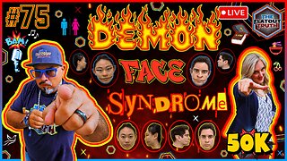 The Flat Out Truth #75 - DEMON FACE SYNDROME