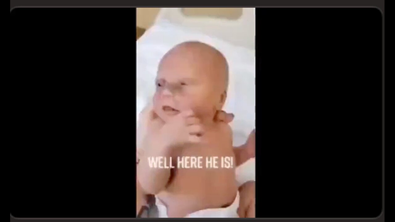 Another black eyed child. Is anyone noticing this? How about nurses in maternity wards? Anyone?’