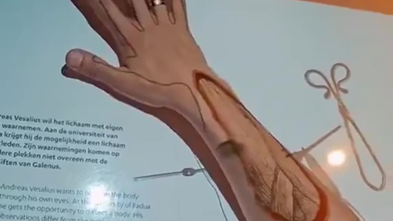 An incredible medical projector