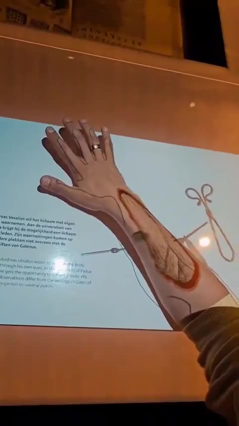 An incredible medical projector