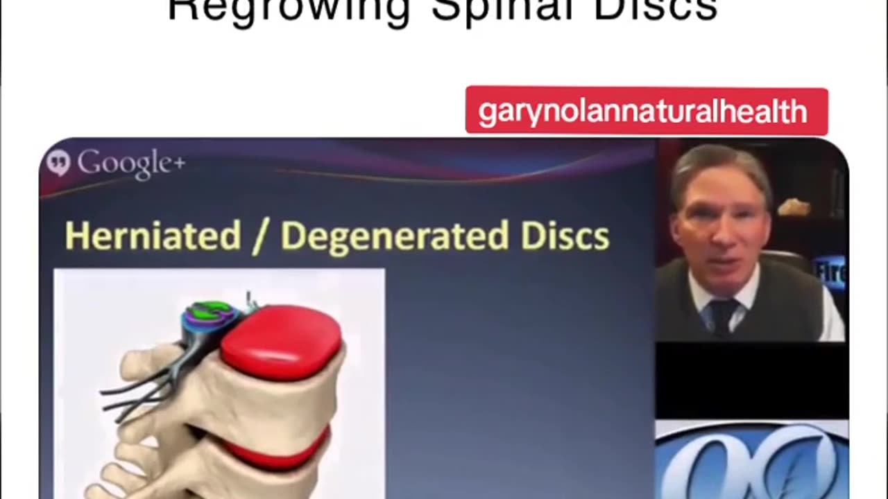 Degenerative Disease is preventable