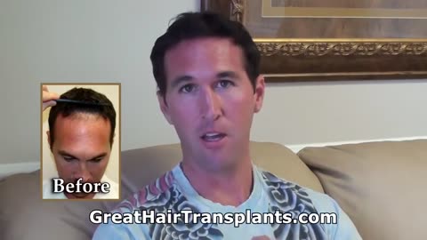 Great Hair Transplants: Receding Hairline Restoration by Dr. Brett Bolton
