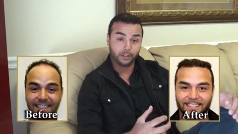 Dr. Brett Bolton Performs Corrective Hair Surgery for FUE Scars