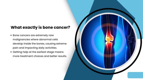 Bone Cancer Treatment | Bone Cancer Specialist| Orthopedic Oncology Doctors