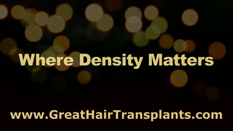 Amazing Hair Transplant Testimonial by Dr. Brett Bolton’s Patient