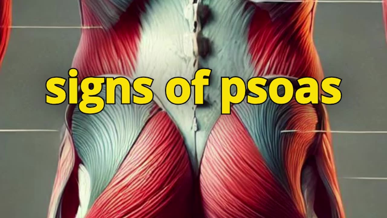 Signs of Psoas Dysfunction