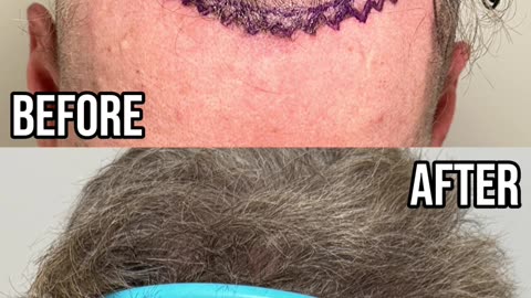 8 Month Patient Follow Up!