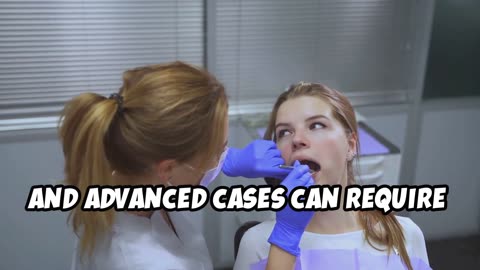 Gingivitis vs. Periodontal Disease: Habits for Healthy Gums!