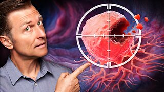 Advanced-Stage Colon Cancer Dies When You Do THIS