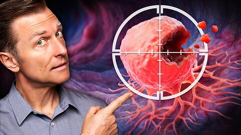 Advanced-Stage Colon Cancer Dies When You Do THIS