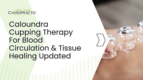 Caloundra Cupping Therapy For Blood Circulation & Tissue Healing Updated