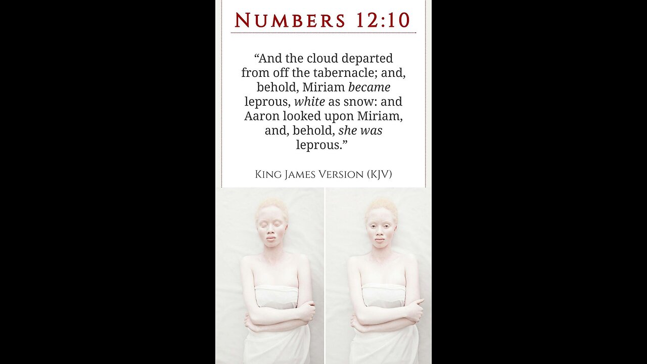 Miriam Relationship with leperous