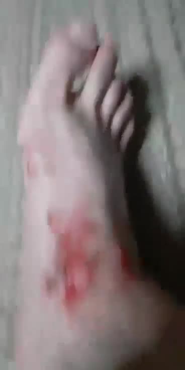 Cyraxx scratching himself with his poo-ridden claws. 3/27/2025