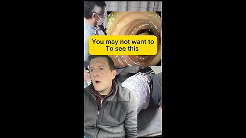 Parasites …. Are you infested ?