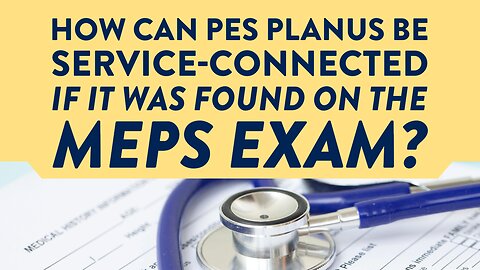 How can pes planus be service-connected if it was found on the MEPS exam?