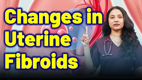 Changes in Uterine Fibroids | Treatment Cure Medicine Surgery | Gynaecology Women Female |