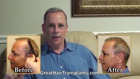 Wichita Kansas Best Hair Transplant Surgeons for Men & Women – Promo