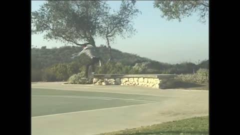 ETS Hyperhidrosis Surgery - The Surgery that RUINED my life - Sympathectomy #hyperhidrosis