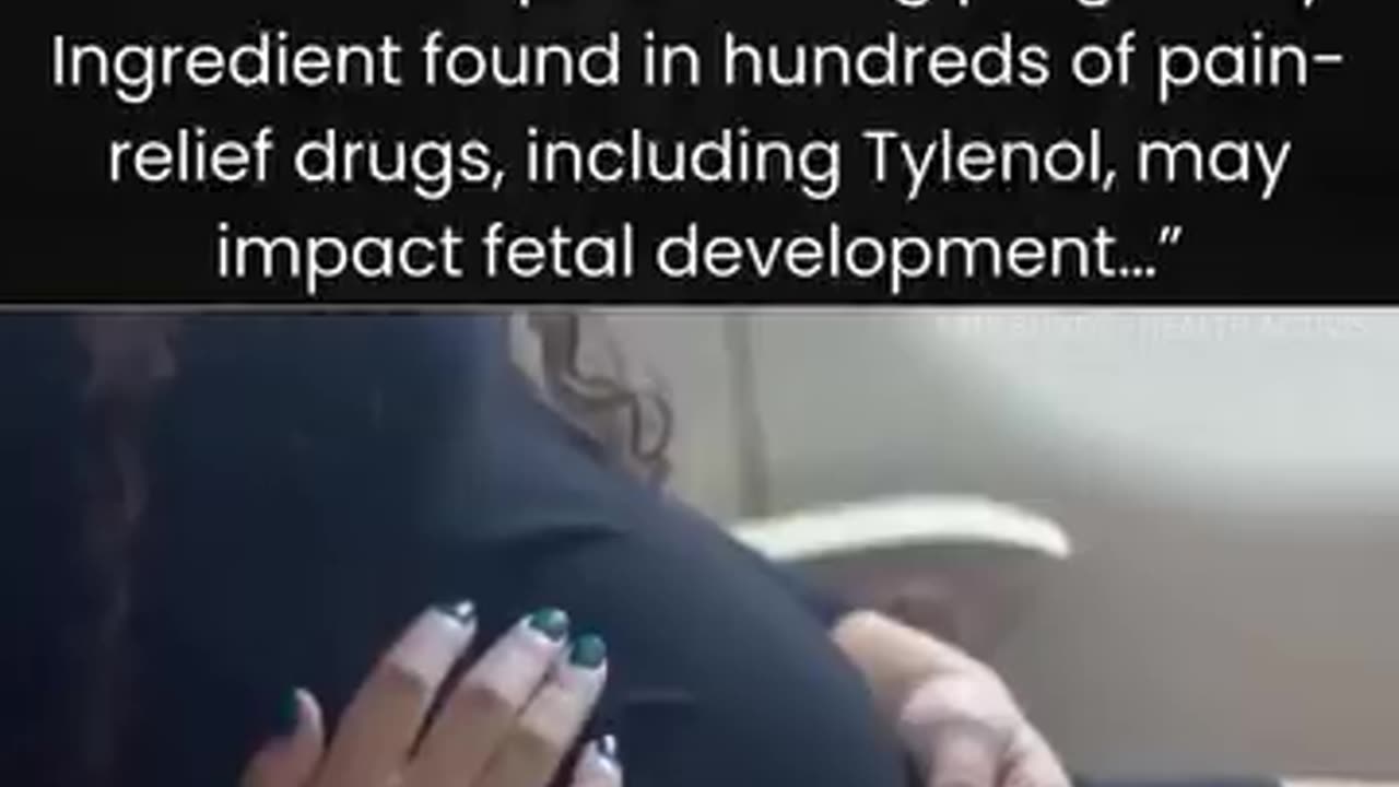 Medical experts urge caution over use of acetaminophen during pregnancy