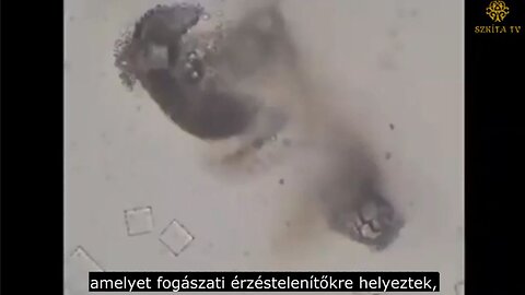 A nikotin elpusztítja a nanochipeket - fogászati érzéstelenítő mikroszkóp alatt