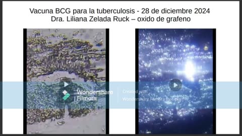 Analisis VACUNAS COVID y calendario microscopia optica OXIDO DE GRAFENO