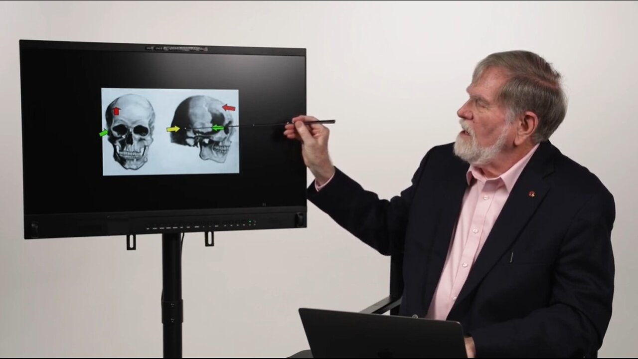 Doug Horne on the JFK "Three Headshot Scenario' with which Drs Chesser and Mantik Both Agree