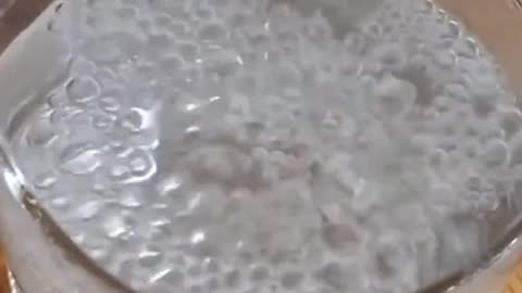 Coconut oil for brain health