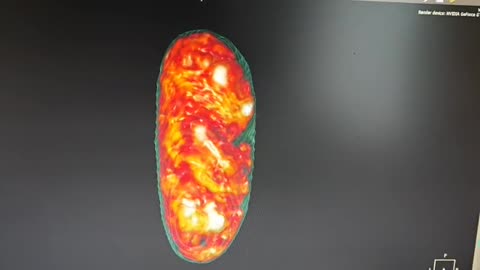 🐣🤯 The Baby Inside Josefina's Egg: Unbelievable Details! | TheTruthAbove