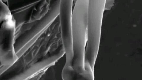 IN 2021, DR. ZALEWSKI FOUND THESE PARASITIC CREATURES IN COVID SHOTS CALLED “THE THING”