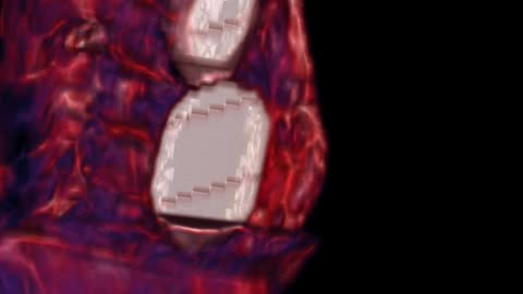 👽🔬 Josephina's Blood Vessels - Are They Human? | TheTruthAbove