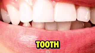 🦷TEETH🦷: Reversing a CAVITY? Simple Recipe
