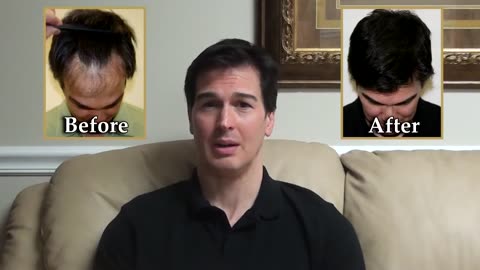 Dr. Brett Bolton Hair Transplant | Temple Restoration & Lowering Frontal Hairline