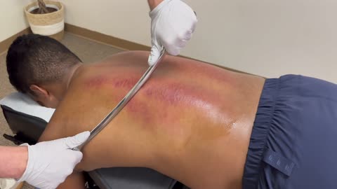 MASSIVE POPS AND EXCELLENT TOXIN RELEASE