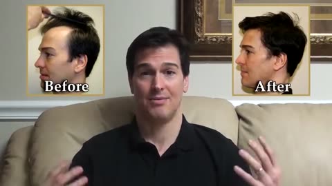 Dr. Brett Bolton Performs Temple Restoration and Hairline Lowering