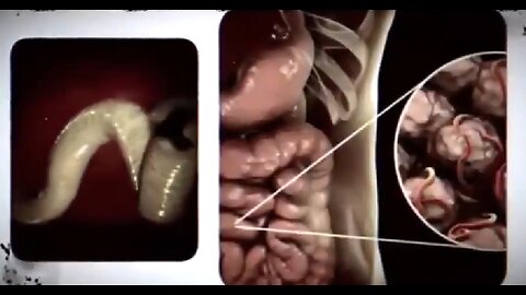 PARASITES, DEMONS & VIBRATIONS - THE TRUTH ABOUT PARASITES 💣