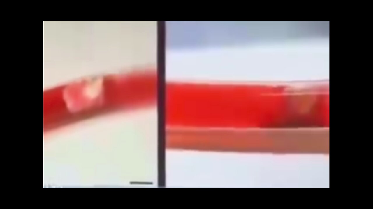 WHY ITS IMPORTANT TO DETOX (NANOBOTS)