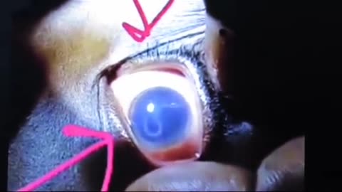 😱👻 Weird Worm-Like Creature Found in Deceased Boy's Eye! Ghostly Toksa | TheHauntingHour