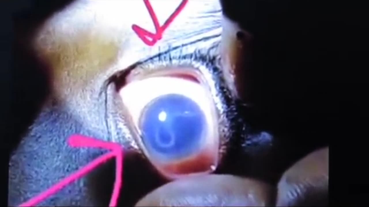 😱👻 Weird Worm-Like Creature Found in Deceased Boy's Eye! Ghostly Toksa | TheHauntingHour
