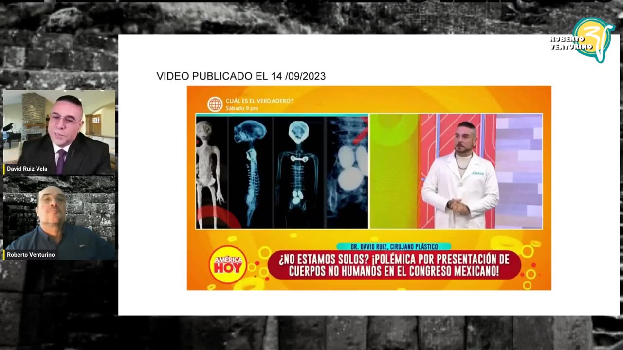 👽🤯 Dr. David Ruiz Vela Explains Medical Scans of the 60cm Tridactyl! | TheTruthAbove