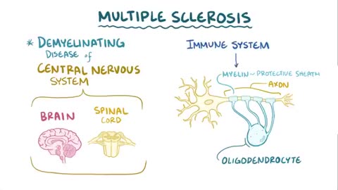 Multiple sclerosis - causes, symptoms, diagnosis, treatment, pathology