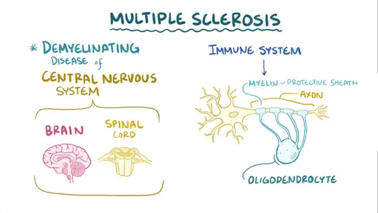 Multiple sclerosis - causes, symptoms, diagnosis, treatment, pathology