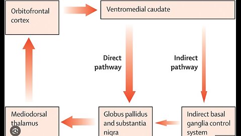 The Crudity of the Obsessive-Compulsive Left