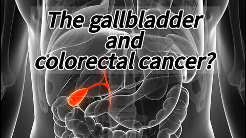The Gallbladder and Colorectal Cancer?