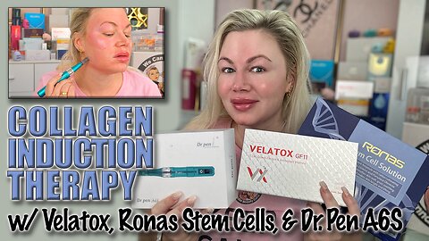 Collagen Induction Therapy w Velatox, Ronas Stem Cells & Dr.Pen! AceCosm.com, code Jessica10 Saves