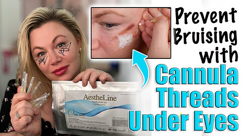 Prevent Bruising with Cannula PCL Under Eye Threads! ACeCosm.com and code Jessica10 Saves you money