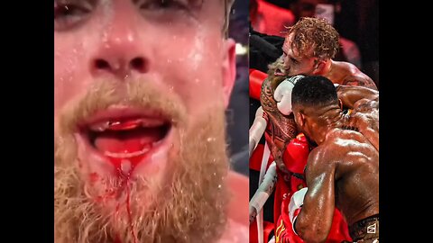 Actually no bro its not fine 😭