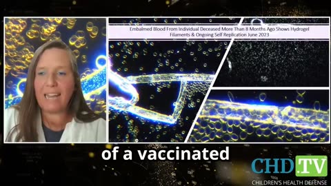 The same thing has been found in all childhood vaccines