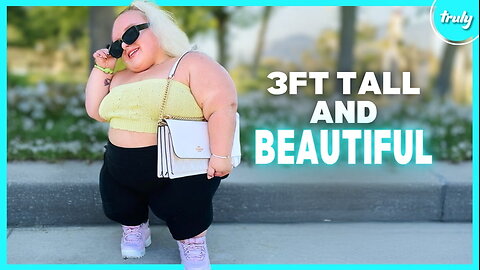 My Rare Dwarfism Makes Me Look “Smooshed Together” | BORN DIFFERENT